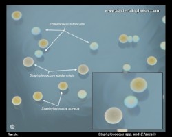 staph aureus, staph epidermidis, enterococcus faecalis on tryptic soy agar